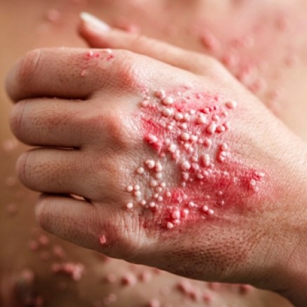 50 YAŞ ÜSTÜ İÇİN KRİTİK UYARI: VÜCUDUNUZDAKİ VİRÜS HER AN UYANABİLİR!